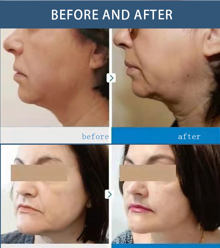 2 in 1 HIFU Machine for Face and Body Contouring