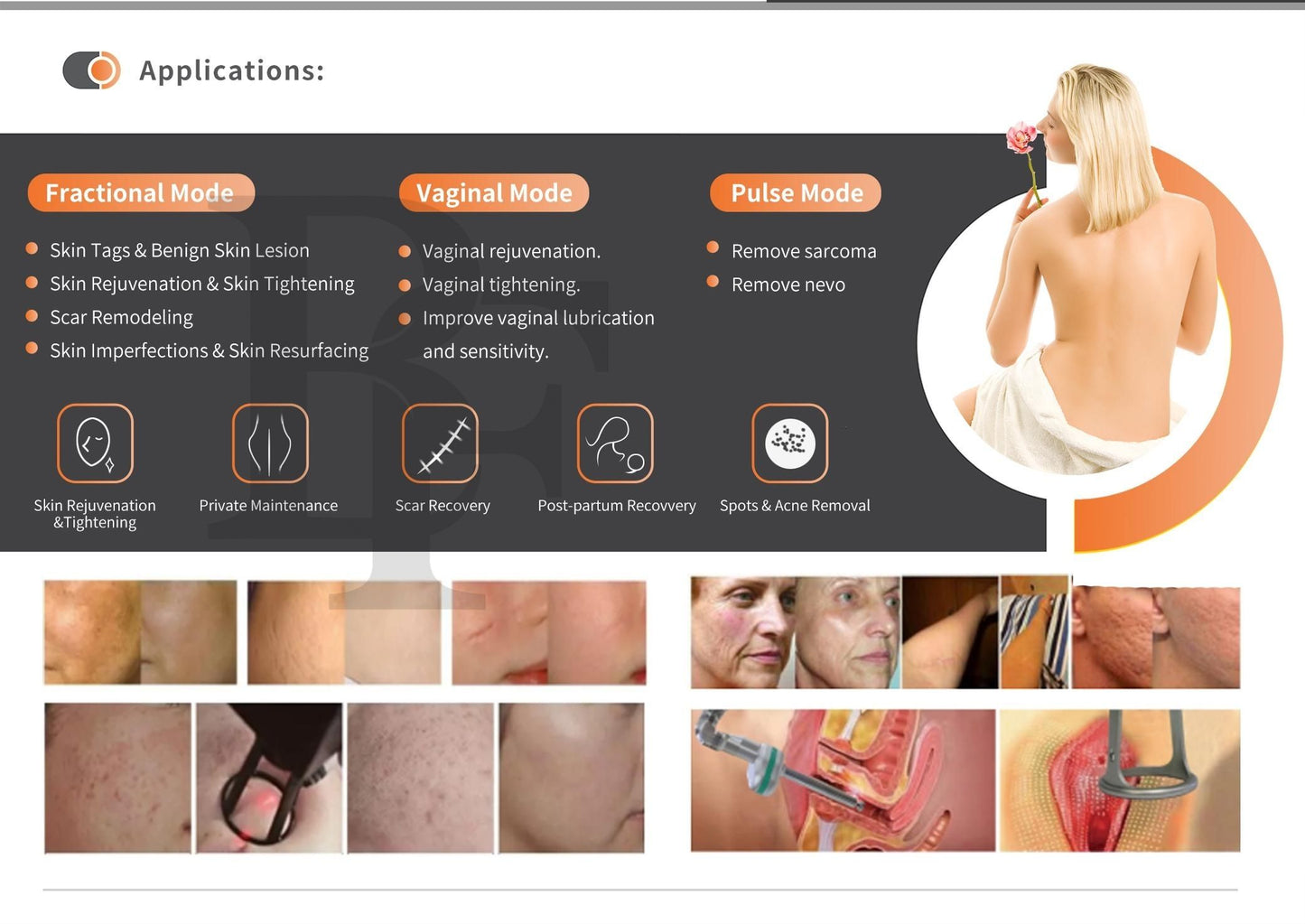 BV Laser 60W Co2 Fractional Laser / OEM Imported / High Performance / US FDA Approved