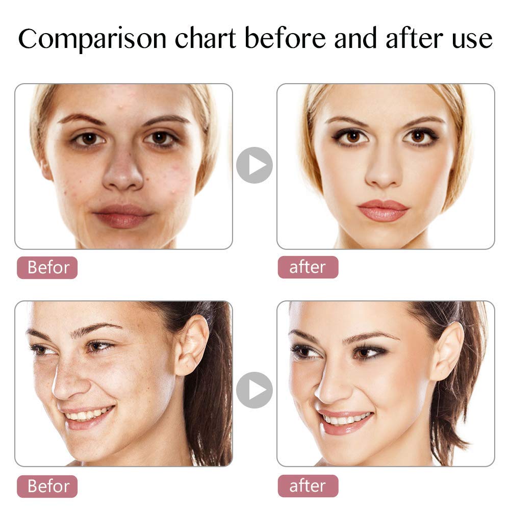 Led Face Mask Light Therapy, 7 Led Light Therapy Facial Skin Care Mask, Blue & Red Light for Acne Photon Mask, Korea PDT Technology for Acne Reduction