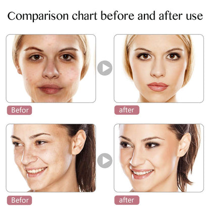 Led Face Mask Light Therapy, 7 Led Light Therapy Facial Skin Care Mask, Blue & Red Light for Acne Photon Mask, Korea PDT Technology for Acne Reduction