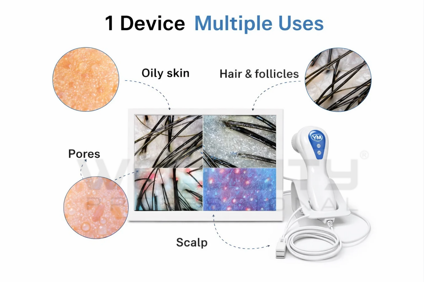 Hair & Skin Analyzer Dermascope – 11.3 Inch HD Display (50X / 200X)