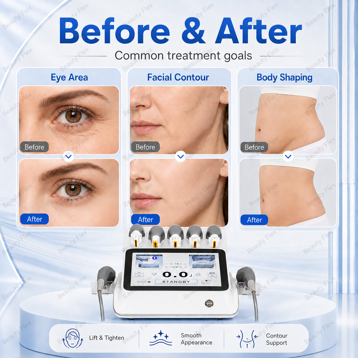7D HIFU face lifting and skin tightening before and after appearance