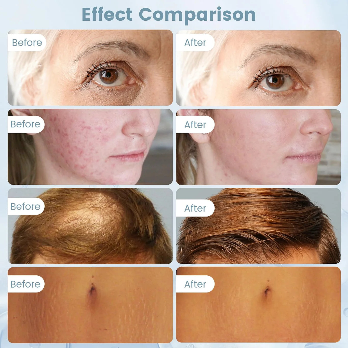 Dr. Pen HydraPen H3 Serum Microneedling Pen